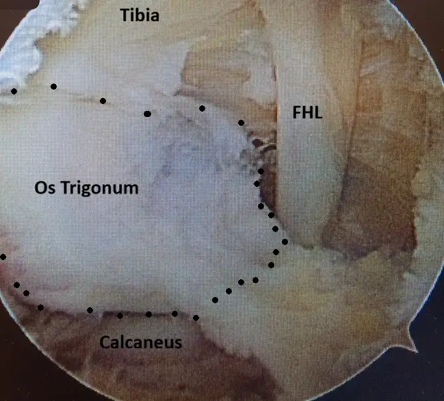 Takanilkan tähystys ja anatomia